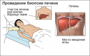 Новости про - Эластометрия печени, что это такое, её нормальные показатели и подготовка к процедуре