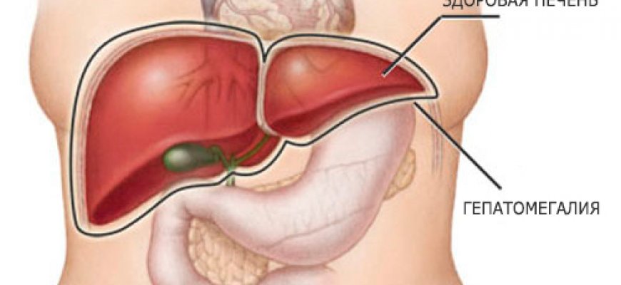 Новости про - Гепатомегалия печени, симптомы у взрослых и детей и как выздороветь
