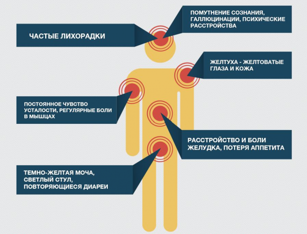 Новости про - Гепатит ц - вирус, первые признаки, можно ли вылечить HCV полностью и навсегда