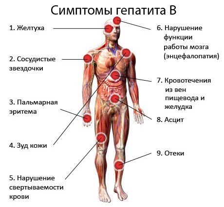 Новости про - Гепатит b, признаки у женщин и мужчин, чем опасен HBV, сколько живут и можно-ли выздороветь