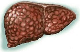 Новости про - Можно ли вылечить фиброзные изменения печени, их признаки и стадии
