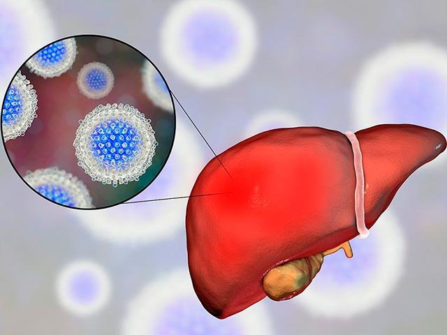 Новости про - Как передается гепатит С - пути заражения, где можно заразиться гепатитом С