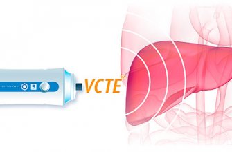 Новости про - Эластометрия печени, что это такое, её нормальные показатели и подготовка к процедуре